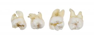 teeth health smile dentist baby