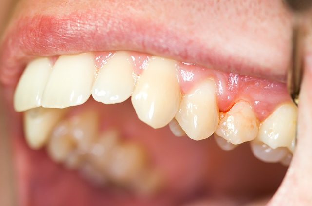 smile health beauty teeth
