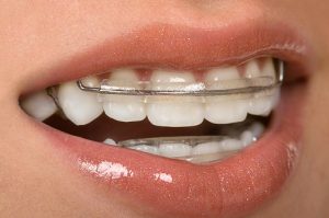 teeth, health, smile,dentist, dentalhealth, oralhealth