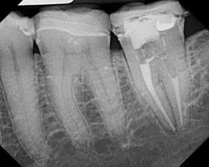 teeth, health, smile,dentist, oralhealth, dentalhealth