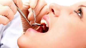 teeth, health, smile,dentist, dentalhealth, oralhealth