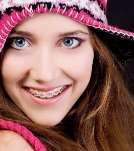 teeth, health, smile,dentist, dentalhealth, oralhealth