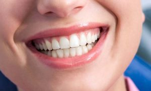 teeth, health, smile,dentist, dentalhealth, oralhealth